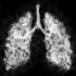عفونت حاد تنفسی و هر آنچه که باید بدانید