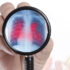 علائم عفونت دستگاه تنفسی فوقانی؛ علت و راه های درمان