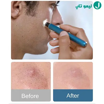 قلم پاکسازی پوست بیوتی پن